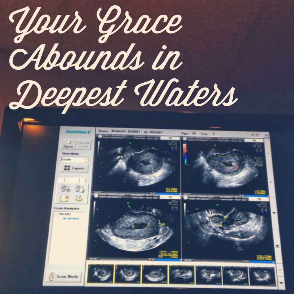 walking through a miscarriage